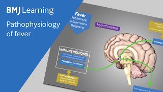 Pathophysiology of fever explained [upl. by Gnoix]