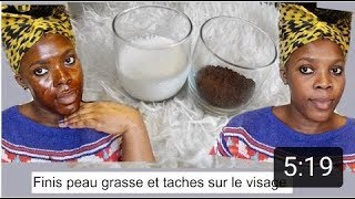 COMBATTRE LA PEAU GRASSE BOUTONS ET TACHES SUR LE VISAGE  AMOR AMOUR [upl. by Vera]