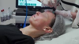 Hydrafacial  la séance complète de nettoyage de peau [upl. by Euqirdor]